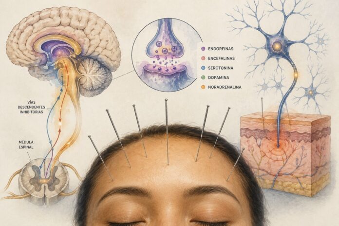 La ciencia explica cómo la acupuntura activa los mecanismos naturales del dolor Ilustración científica que muestra cómo la acupuntura activa los mecanismos naturales del dolor mediante la participación del cerebro, las neuronas y el sistema nervioso.
